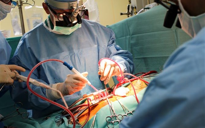 The Latest Advances in Heart Surgery: Innovative Techniques and Technologies