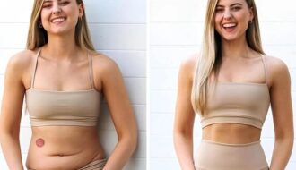 Berberine Weight Loss Patches