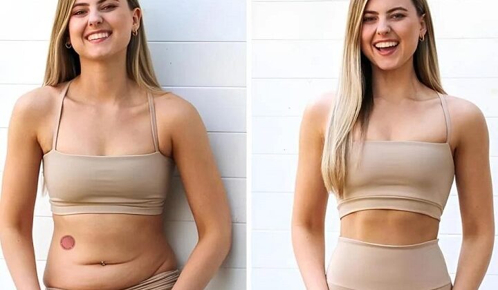 Berberine Patches Reviews – GLP-1 Patch for Metabolic Support & Weight Management!