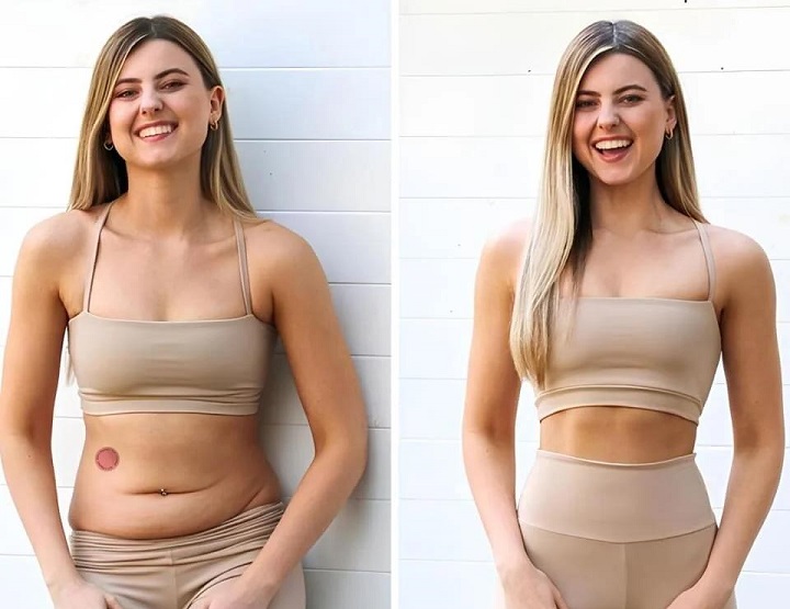 Berberine Weight Loss Patches